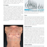 Plastic Surgery Volume 5: Breast 4th Edicion 2018