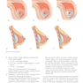 Plastic Surgery Volume 5: Breast 4th Edicion 2018