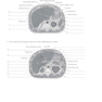 Workbook for Textbook of Diagnostic Sonography 8th Edicion