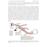 Local Anesthesia and Extractions for Dental Students : Simple Notes and Guidelines 2018