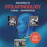 Imaging in Otolaryngology 1st Edición