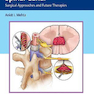 Tumors of the Spinal Canal: Surgical Approaches and Future Therapies 1st Edición