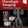 Oncologic Imaging: A Multidisciplinary Approach 2nd Edición