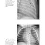 Recognizing Child Abuse in Radiology 1st ed. 2017 Edicion