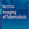 Imaging of Tuberculosis