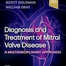 Diagnosis and Treatment of Mitral Valve Disease A Multidisciplinary Approach