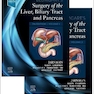 Blumgart’s Surgery of the Liver, Biliary Tract and Pancreas