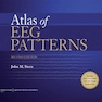 Atlas of EEG Patterns