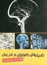 تخفیف تکنیک های رادیولوژی در گذر زمان