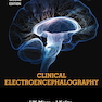 Clinical Electroencephalography, 2nd Edition