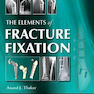 The elements of fracture fixation, 4e Kindle Edition