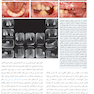 طرح درمان در دندانپزشکی ترمیمی و پروتزهای ایمپلنت