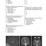 Neurosurgery Primary Examination Review: High Yield Questions, Answers, Diagrams, and Tables 1st Edicion 2019