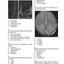 Neurosurgery Primary Examination Review: High Yield Questions, Answers, Diagrams, and Tables 1st Edicion 2019