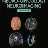 Handbook of Neuro-Oncology Neuroimaging 3rd Edition