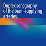 Duplex sonography of the brain-supplying arteries Kindle Edition