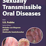 Sexually Transmissible Oral Diseases 1st Edition, Kindle Edition
