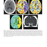 Neurosurgery Knowledge Update : A Comprehensive Review 2015