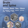 ExpertDDx: Brain and Spine 3rd Edicion 2024