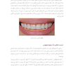 لمینیت های سرامیکی در دندانپزشکی