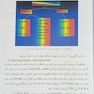 سنجش تراکم استخوان (دانسیتومتری)