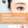 Asian Blepharoplasty and the Eyelid Crease  4th Edition