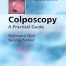 Colposcopy: A Practical Guide 2nd Edition