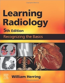 Learning Radiology Recognizing the Basics 5th Edition 2024