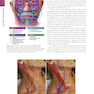 The Art and Science of Facelift Surgery 2nd Edition 2024