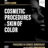 Procedures in Cosmetic Dermatology: Cosmetic Procedures in Skin of Color