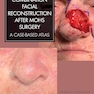 Combination Facial Reconstruction after Mohs Surgery: A Case Based Atlas 1st Edition