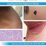 Pediatric Collections: Dermatology Cases: Case Reports from Pediatrics in Review