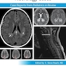 Pediatric Collections: Neurology Cases: Case Reports from Pediatrics in Review