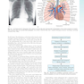 Sabiston and Spencer Surgery of the Chest 10th Edition