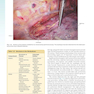 Sabiston and Spencer Surgery of the Chest 10th Edition