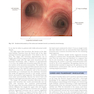 Sabiston and Spencer Surgery of the Chest 10th Edition