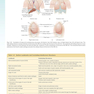 Sabiston and Spencer Surgery of the Chest 10th Edition