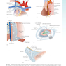 Sabiston and Spencer Surgery of the Chest 10th Edition