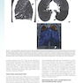 Sabiston and Spencer Surgery of the Chest 10th Edition