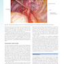 Sabiston and Spencer Surgery of the Chest 10th Edition