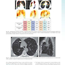 Sabiston and Spencer Surgery of the Chest 10th Edition