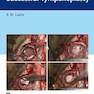 An Approach to Successful Tympanoplasty 1st Edition