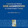 Horizontal and Vertical Bone Augmentation for Dental Implant Therapy