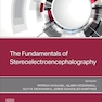 The Fundamentals of Stereoelectroencephalography 1st Edition