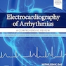 Electrocardiography of Arrhythmias: A Comprehensive Review: A Companion to Cardiac Electrophysiology 2nd Edition