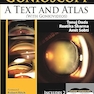 Gonioscopy: A Text and Atlas 1st Edition