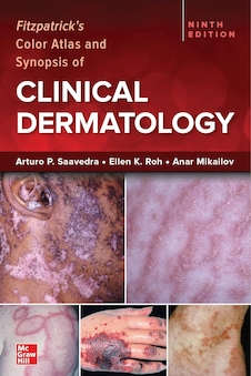 Fitzpatrick's Color Atlas and Synopsis of Clinical Dermatology, Ninth Edition 2023