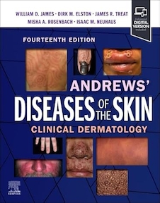 Andrews' Diseases of the Skin: Clinical Dermatology, 14th Edition
