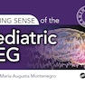 Making Sense of the Pediatric EEG 1st Edition