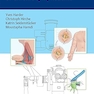 Modern Surgical Management of Chronic Lymphedema 1st Edition